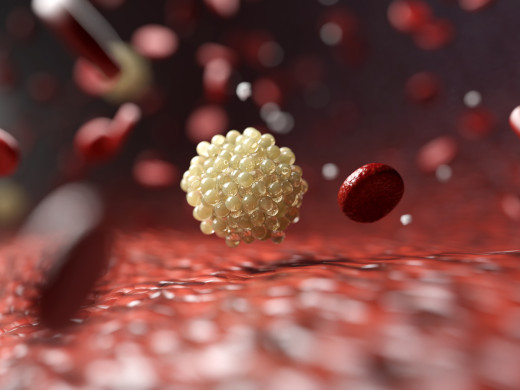 XI. česko-slovenská lipidová akademie